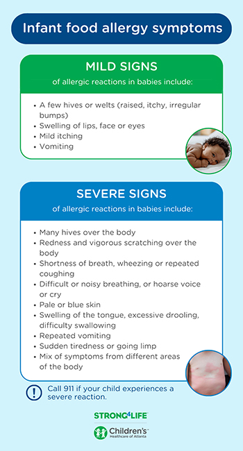 Diagram showing the mild and severe signs of an allergic reaction